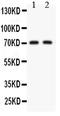 Potassium Voltage-Gated Channel Subfamily D Member 2 antibody, PB9228, Boster Biological Technology, Western Blot image 