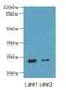 Retinal Degeneration 3, GUCY2D Regulator antibody, A65946-100, Epigentek, Western Blot image 