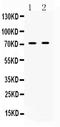 IL2 Inducible T Cell Kinase antibody, A01385-2, Boster Biological Technology, Western Blot image 