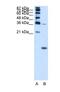 Hemoglobin Subunit Zeta antibody, NBP1-56354, Novus Biologicals, Western Blot image 