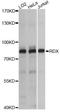 RDX antibody, LS-C749759, Lifespan Biosciences, Western Blot image 