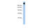 Polycystin Family Receptor For Egg Jelly antibody, 25-247, ProSci, Enzyme Linked Immunosorbent Assay image 