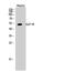 Glucagon Like Peptide 1 Receptor antibody, A00753-1, Boster Biological Technology, Western Blot image 