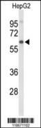 Afamin antibody, 63-950, ProSci, Western Blot image 