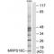 Mitochondrial Ribosomal Protein S18C antibody, A15620, Boster Biological Technology, Western Blot image 