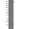 Leucine Rich Repeat Kinase 2 antibody, abx147472, Abbexa, Western Blot image 