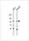 Adaptor Related Protein Complex 2 Subunit Alpha 2 antibody, 63-513, ProSci, Western Blot image 