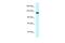 BCL2 Associated Athanogene 6 antibody, A00967, Boster Biological Technology, Western Blot image 