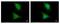 Laforin antibody, PA5-28073, Invitrogen Antibodies, Immunofluorescence image 