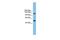 Phosphoribosylglycinamide Formyltransferase, Phosphoribosylglycinamide Synthetase, Phosphoribosylaminoimidazole Synthetase antibody, GTX46531, GeneTex, Western Blot image 