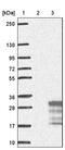 Cystatin F antibody, PA5-59181, Invitrogen Antibodies, Western Blot image 