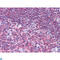 Protein Tyrosine Kinase 2 Beta antibody, LS-C814067, Lifespan Biosciences, Immunohistochemistry paraffin image 