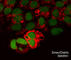 Diablo homolog, mitochondrial antibody, SM3591, ECM Biosciences, Immunocytochemistry image 