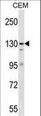 ERCC Excision Repair 5, Endonuclease antibody, LS-C159562, Lifespan Biosciences, Western Blot image 