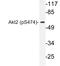 AKT Serine/Threonine Kinase 2 antibody, LS-C178000, Lifespan Biosciences, Western Blot image 