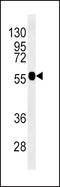 Tubulin Beta 3 Class III antibody, LS-C203711, Lifespan Biosciences, Western Blot image 