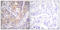 LCK Proto-Oncogene, Src Family Tyrosine Kinase antibody, LS-C199195, Lifespan Biosciences, Immunohistochemistry frozen image 