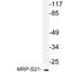 Mitochondrial Ribosomal Protein S21 antibody, LS-C177467, Lifespan Biosciences, Western Blot image 