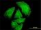Pepsin A antibody, H00005222-M02, Novus Biologicals, Immunocytochemistry image 