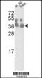 Methylosome subunit pICln antibody, MBS9204232, MyBioSource, Western Blot image 