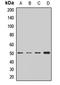 Branched Chain Keto Acid Dehydrogenase E1 Subunit Alpha antibody, LS-C667661, Lifespan Biosciences, Western Blot image 