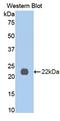 Interleukin 13 Receptor Subunit Alpha 1 antibody, LS-C374187, Lifespan Biosciences, Western Blot image 