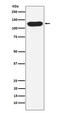 Nicastrin antibody, M03144-1, Boster Biological Technology, Western Blot image 