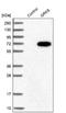 G Protein-Coupled Receptor Kinase 6 antibody, NBP1-83334, Novus Biologicals, Western Blot image 