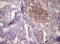 Lysyl Oxidase Like 2 antibody, TA807440S, Origene, Immunohistochemistry paraffin image 