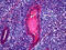 Mucin 16, Cell Surface Associated antibody, 51-660, ProSci, Immunohistochemistry paraffin image 