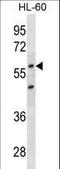 Cyclin Dependent Kinase Inhibitor 1C antibody, LS-C159325, Lifespan Biosciences, Western Blot image 