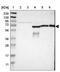 GRB2 Associated Binding Protein 3 antibody, NBP1-86111, Novus Biologicals, Western Blot image 