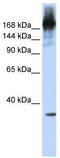 Pre-MRNA Processing Factor 8 antibody, TA345964, Origene, Western Blot image 