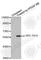 SRC Proto-Oncogene, Non-Receptor Tyrosine Kinase antibody, AP0452, ABclonal Technology, Western Blot image 