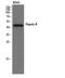 Pepsin A antibody, STJ95025, St John