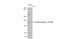 Rho Associated Coiled-Coil Containing Protein Kinase 2 antibody, GTX122651, GeneTex, Western Blot image 