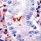 Helicobacter pylori antibody, LS-C88771, Lifespan Biosciences, Immunohistochemistry paraffin image 