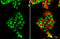 Androgen Receptor antibody, GTX636021, GeneTex, Immunofluorescence image 