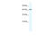 Zinc Finger MYM-Type Containing 6 antibody, 28-203, ProSci, Western Blot image 