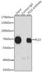 Plastin 3 antibody, GTX33552, GeneTex, Immunoprecipitation image 