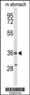 Bombesin Receptor Subtype 3 antibody, 63-964, ProSci, Western Blot image 