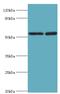 Serine/threonine-protein kinase 3 antibody, MBS1493080, MyBioSource, Western Blot image 