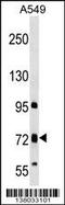 Transmembrane Channel Like 4 antibody, 59-479, ProSci, Western Blot image 