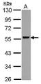 Aldehyde Dehydrogenase 1 Family Member A1 antibody, PA5-32159, Invitrogen Antibodies, Western Blot image 