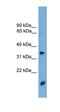 Transmembrane Serine Protease 3 antibody, orb330937, Biorbyt, Western Blot image 