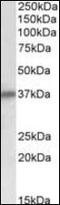 Sarcoglycan Delta antibody, orb96454, Biorbyt, Western Blot image 