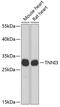 Troponin I3, Cardiac Type antibody, 13-057, ProSci, Western Blot image 