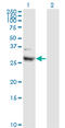 Cell Death Inducing DFFA Like Effector A antibody, LS-C196921, Lifespan Biosciences, Western Blot image 