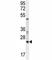 RAN, Member RAS Oncogene Family antibody, F49795-0.4ML, NSJ Bioreagents, Western Blot image 