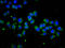 Signal Peptide, CUB Domain And EGF Like Domain Containing 1 antibody, LS-C681263, Lifespan Biosciences, Immunofluorescence image 